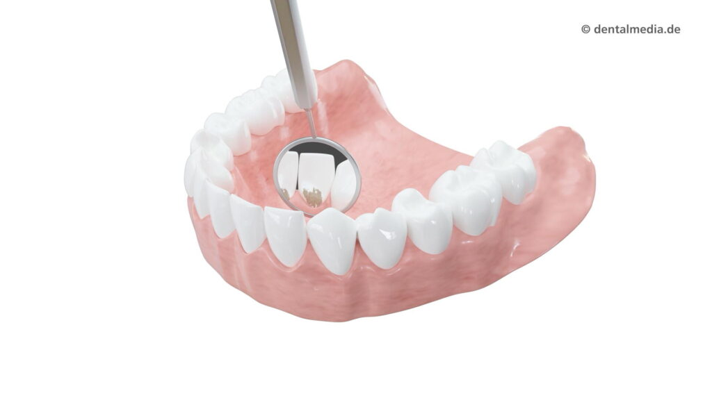 Prophylaxe — DENTOPLUS | Ihre Praxis für Zahnheilkunde in Moers