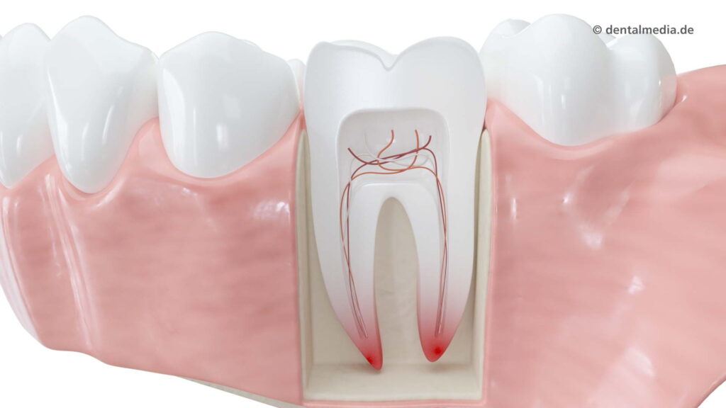 Wurzelbehandlung — DENTOPLUS | Ihre Praxis für Zahnheilkunde in Moers